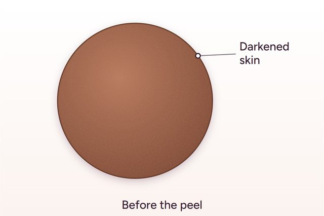 Before: Intimate area lightening