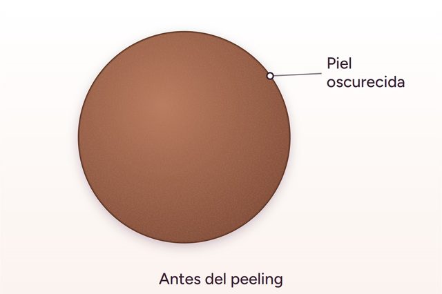 Antes: Aclaramiento de la zona íntima
