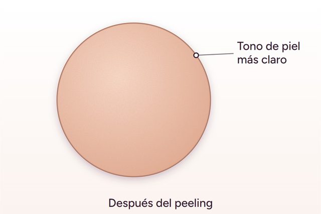 Después: Aclaramiento de la zona íntima