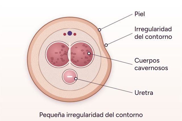 Antes: Armonización genital