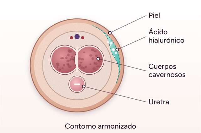 Después: Armonización genital