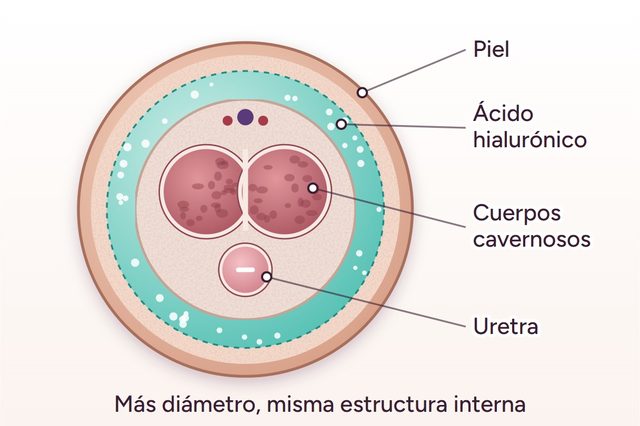 Después: Engrosamiento del pene